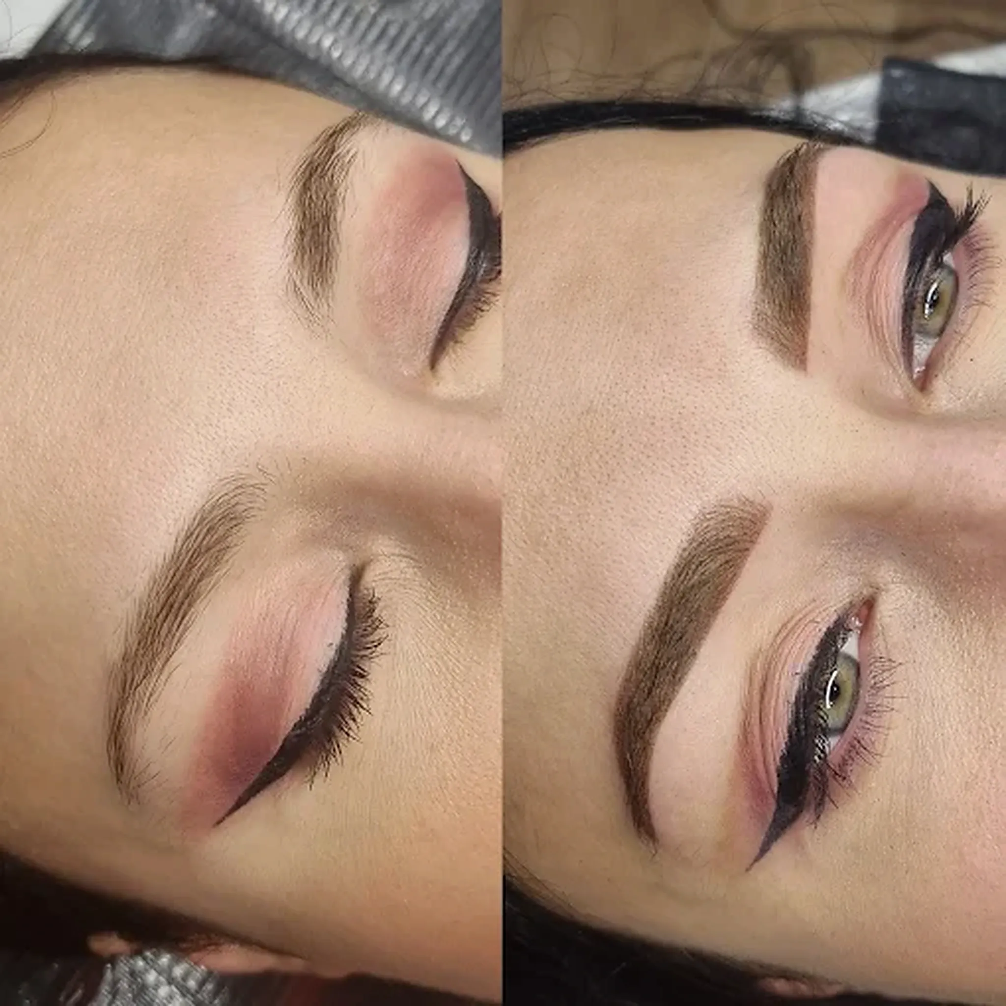 Sourcils avant et après restructuration, vue de face.