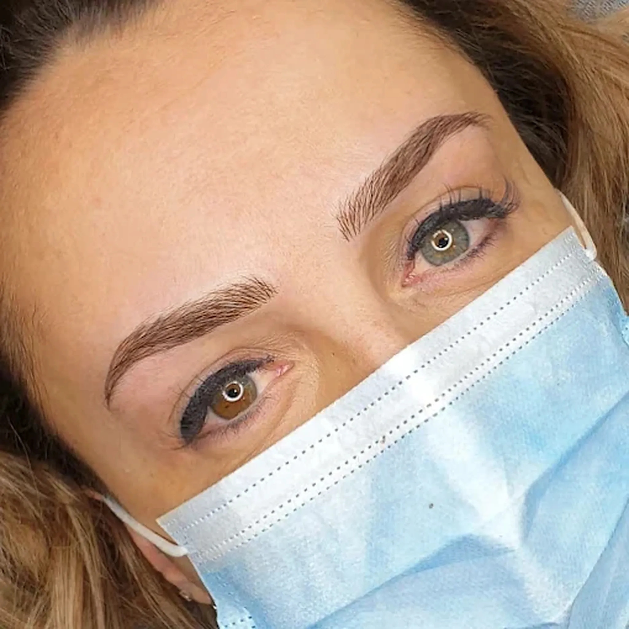 Résultat sourcils au terme d’une restructuration, regard de trois quarts.
